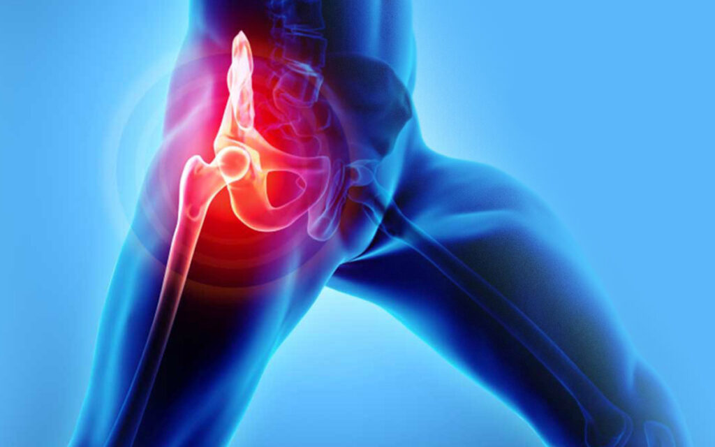 Best Hip Replacement Surgeon in Ahmedabad Dr Ruchir Patel