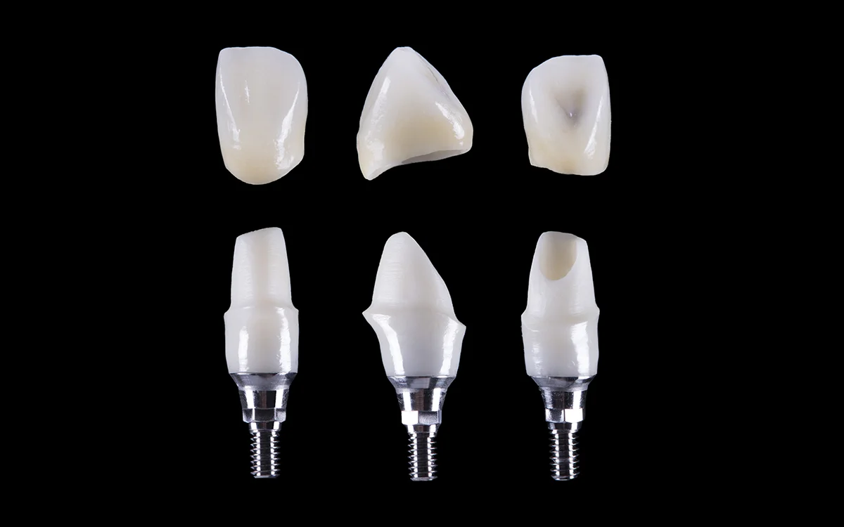 Crowns — Metal, Ceramic & Zirconia