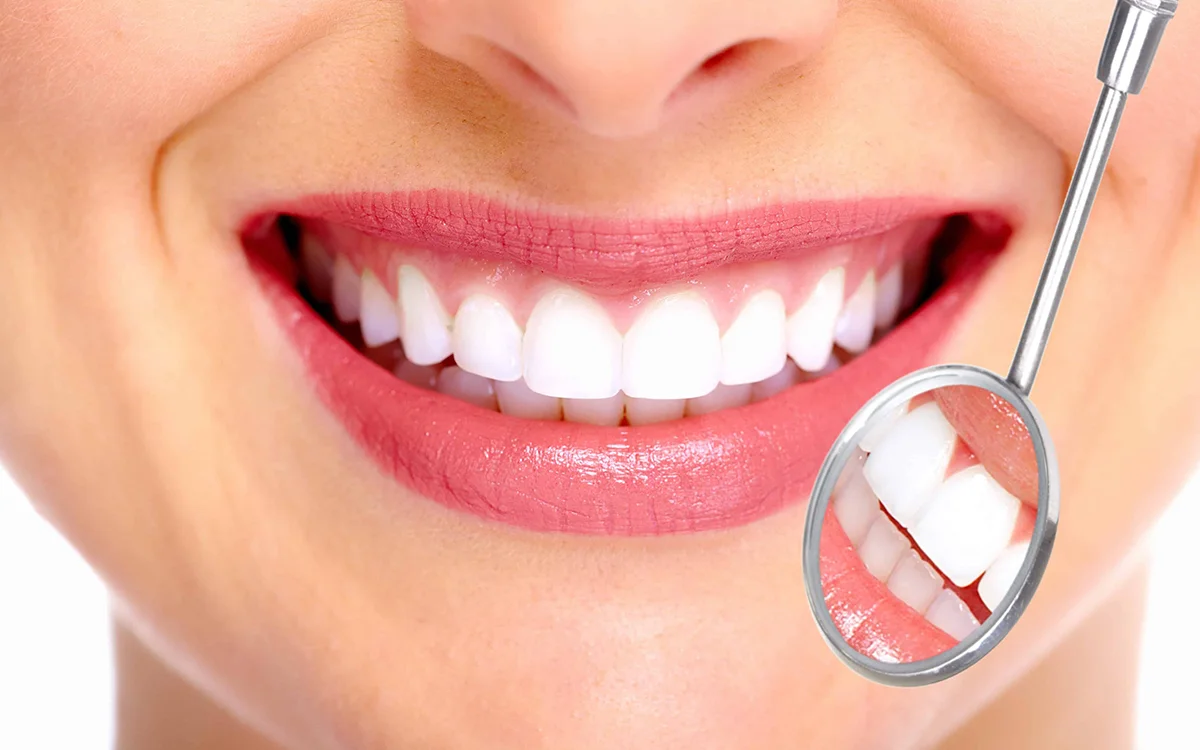 Smile Design